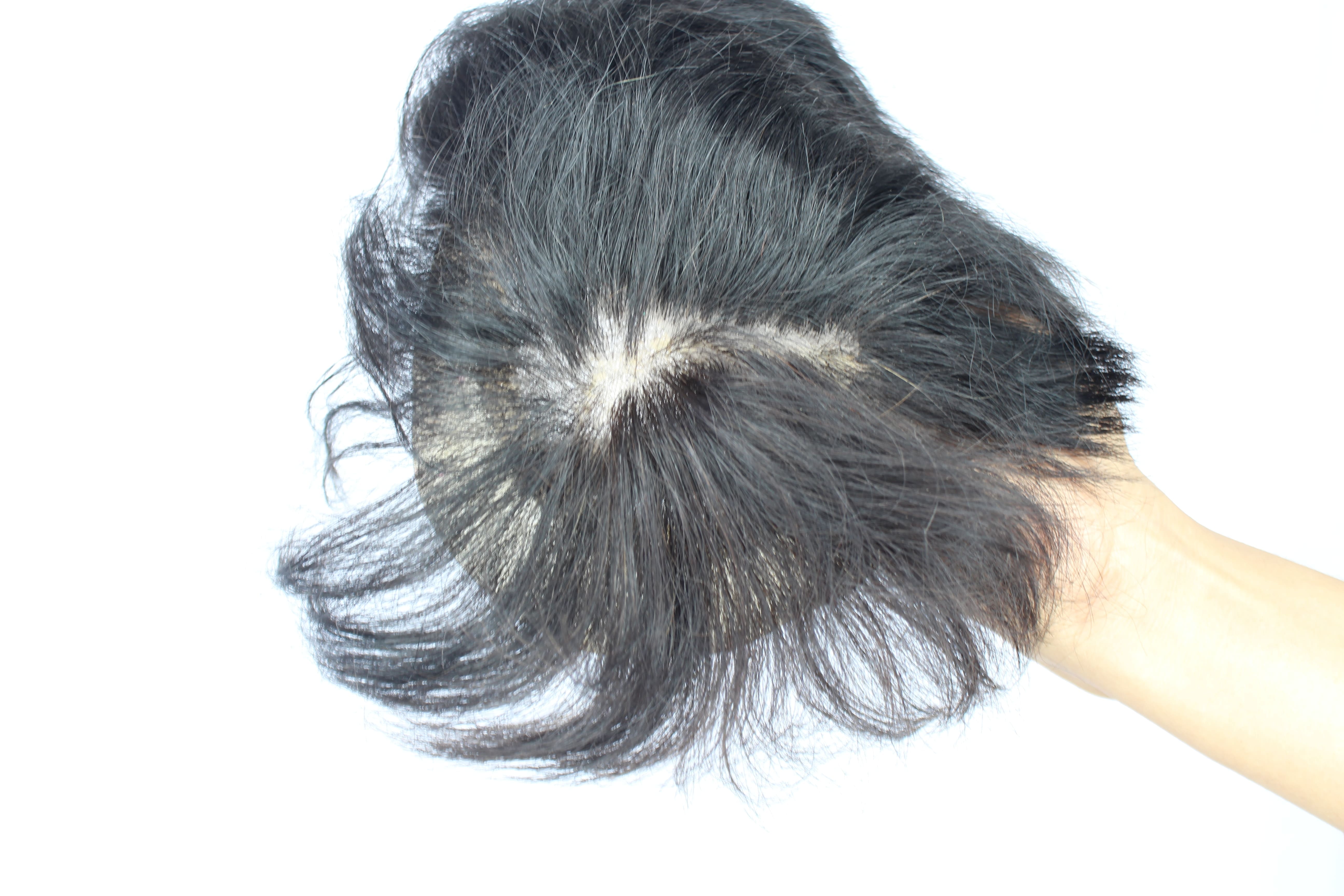 Hair Patch Filling Service In Delhi NCR - Patch Professor