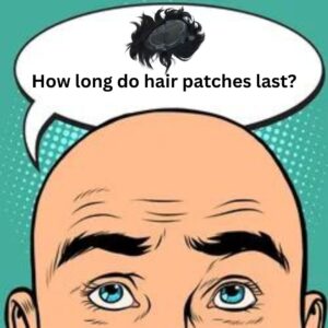 How-long-do-hair-patches-last